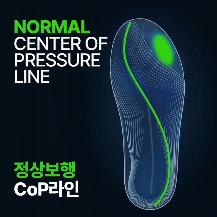 정상 보행 CoP 라인 - 이상적인 압력중심 경로